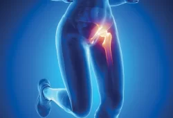Medial Collateral Ligament (MCL) Tear Reconstruction – Dr Mukhi's Raj  Hospital